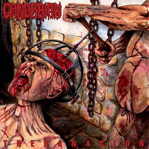 CANDARIAN – Trepanacion CANDARIAN – Trepanacion